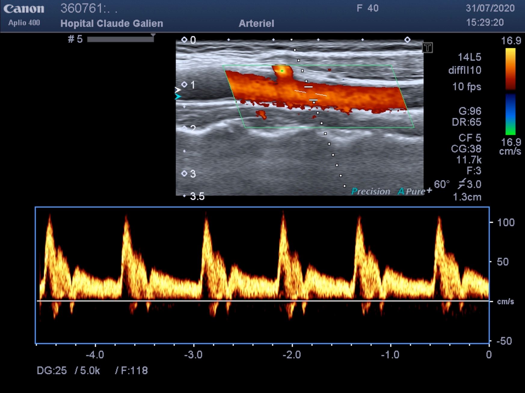 Echographie et Doppler