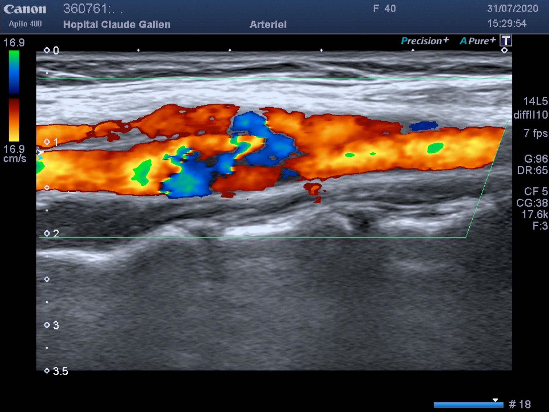 Echographie et Doppler